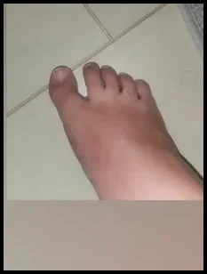 Stacy's ugly feet (@stacysuglyfeet)