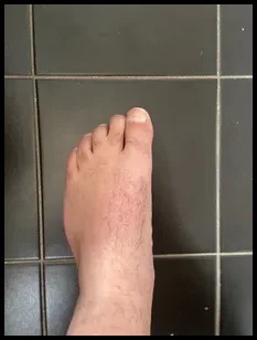Sam’s feet (@juicyfeethere)